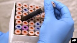 Las investigaciones para descubrir maneras de matar a las bacterias resistentes se ha vuelto una necesidad médica.