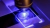 Las investigaciones microbiológicas han permitido a los científicos determinar los rangos de proliferación de los hongos y las enfermedades que causan, la resistencia a medicamentos causa preocupación por lo que la OMS ha focalizado atención en grupos. (Foto ilustrativa AP)