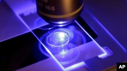 Las investigaciones microbiológicas han permitido a los científicos determinar los rangos de proliferación de los hongos y las enfermedades que causan, la resistencia a medicamentos causa preocupación por lo que la OMS ha focalizado atención en grupos. (Foto ilustrativa AP)