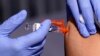 Flu on Rise, RSV Infections May Be Peaking, US Says 