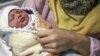 انتقاد روزنامه هم‌میهن از افزایش معلولان در کشور؛ سقط جنین به سالانه ۵۰۰ هزار مورد رسید