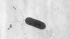 Bakteri Listeria monocytogenes, penyebab penyakit listeria yang menyebar lewat produk daging kemasan bermerek Boar’s Head di AS (foto: dok). 