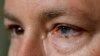 Stem Cells From One Eye Show Promise Healing Injuries in the Other