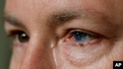 Phil Durst's left eye bore the brunt of a 2017 work accident. He underwent an experimental cell procedure that returned his vision.