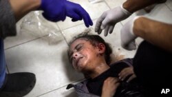 Seorang anak Palestina yang terluka akibat pengeboman di Jalur Gaza sedang dirawat di Rumah Sakit Nasser di Khan Younis, bagian selatan Jalur Gaza, Sabtu, 6 Januari 2024. (Foto: Mohammed Dahman/AP Photo)