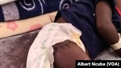 Baboon bites and snatches toddler in West Nicholson