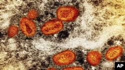 Esta imagen difundida por el Instituto Nacional de Alergias y Enfermedades Infecciosas muestra una imagen captada con un microscopio en el que se ven partículas de viruela símica, en anaranjado, en una célula infectada (marrón), cultivada en un laboratorio. (NIAID via AP)
