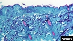 Una sección de tejido de la piel, extraída de una lesión en la piel de un mono que había sido infectado con el virus de la viruela del mono, se ve con un aumento de 50X en el cuarto día del desarrollo de la erupción en 1968. CDC/via REUTERS.