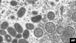 Imagen de un microscopio electrónico proporcionada por los CDC muestra viriones maduros de viruela del mono, obtenidos de una muestra de piel humana asociada con un brote de 2003. (Cynthia S. Goldsmith, Russell Regner/CDC vía AP)