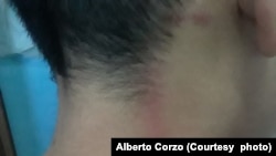 Lesiones sufridas por el hijo de Alberto Corzo, Raidel, quien fue atacado por niños. Corzo dijo que un maestro y adultos alentaron a los niños a atacar a su hijo.