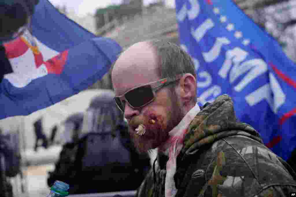 Un manifestante aparece herido durante un enfrentamiento con la policía durante un mitin en el Capitolio en Washington.