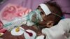 Ukraine War Worsens Already-Dire Humanitarian Crisis in Yemen