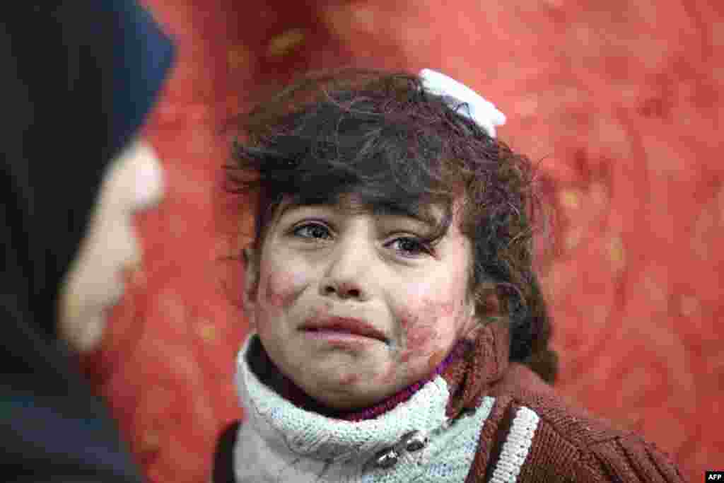 Hala &#39;yar kimanin shekaru 9 tana karbar magani biyo bayan harin da aka kai Syria a birnin Damascus. Febrairu 22, 2018