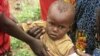  At Lagdo near Garoua, Cameroon, community workers screen Little Mouss for malnutrition. (VOA/D.Ntaryike) 