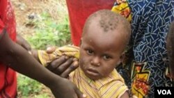 Examen d'un petit enfant, pour s'assurer qu'il est bien nourri