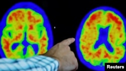 Un médico señala evidencia de la enfermedad de Alzheimer en exploraciones PET en el Centro de Investigación y Tratamiento del Alzheimer (CART) en el Hospital Brigham And Women's en Boston, Massachusetts, EE. UU., 30 de marzo de 2023. REUTERS/Brian Snyder/