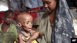 A displaced Somali woman holds her malnourished child inside their temporary home in Hodan district, south of Somalia's capital Mogadishu, September 20, 2011.