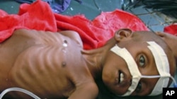UNICEF Airlifts Emergency Nutritional Supplies to Drought Affected Children in Southern Somalia.