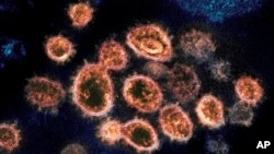 This 2020 electron microscope image provided by the National Institute of Allergy and Infectious Diseases - Rocky Mountain Laboratories shows SARS-CoV-2 virus particles which cause COVID-19. (NIAID-RML via AP)