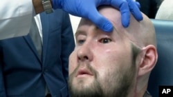 Dr. Eduardo Rodriguez, NYU Langone Health's chair of plastic surgery, examines Aaron James in New York, Oct. 23, 2023. In May 2023, surgeons performed the world’s first transplant of an entire human eye, an extraordinary addition to the face transplant James received.
