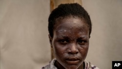 Congo Mpox