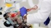 EE.UU. aprueba uso de emergencia de plasma contra COVID-19 