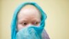 Albino Children Prosthetics