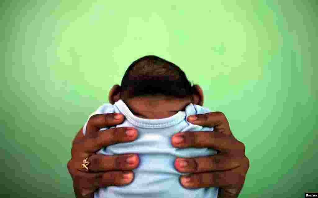 A 4-month-old baby born with microcephaly is held by his mother in front of their house in Olinda, near Recife, Brazil, Feb. 11, 2016.