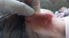 内蒙汉族女教师殴打蒙古族女童致严重伤害，引起蒙古族民众强烈不满