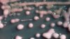 Découverte d'un antibiotique qui ne rencontre pas de résistance