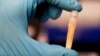 FILE - A lab assistant holds a frozen urine sample before storing it at Biobank, the world's largest blood and urine sample freezer near Manchester, northern England.