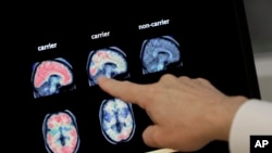 A doctor looks at PET brain scans at Banner Alzheimers Institute in Phoenix on Aug. 14, 2018. (AP Photo/Matt York, File)