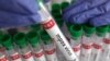Чрезвычайный комитет ВОЗ обсудит ситуацию с оспой обезьян