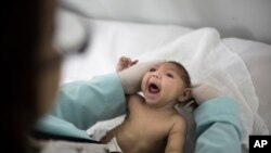 In this Feb. 12, 2016 photo, Lara, who is just under 3- months-old and was born with microcephaly. She is examined by doctors in Paraiba state, Brazil. Paraiba and Pernambuco in Brazilís impoverished northeast are ground zero for the Zika epidemic. (AP Photo/Felipe Dana)