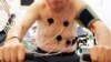 Hello VOA សុខភាព៖ EKG ​ជា​វិធីសំខាន់​មួយ​ដើម្បី​ធ្វើការ​វិនិឆ្ឆ័យ​រោគ​ជំងឺ​គាំង​បេះ​ដូង
