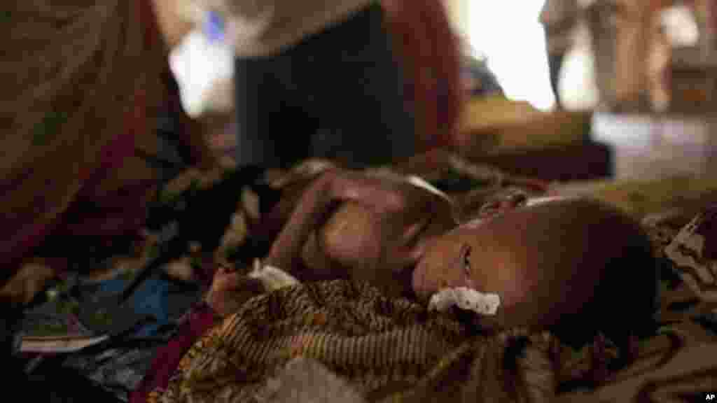 Zara Mahamat, souffrant de malnutrition, diarrhée et de la fièvre, reçoit un traitement par un tube d'alimentation nasal accompagnée de sa mère, dans une tente de soins intensifs à l'hôpital de N'Gouri, au Tchad, le mercredi 1er Avril. (AP Photo / Ben Curtis)
