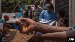 Mara lafiya mai fama da mpox a asibitin Kavumu, jamhuriyar dimokradiyyar Congo.