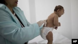 Bayi lahir dengan microsephaly (Foto: dok.)