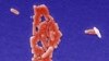 Salmonella Turned Cancer Killing Super Bug
