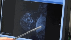 A new study suggests that genetic "bad luck," which predisposes us to cancer, may be less of an influence on our risk for the disease than environmental factors.