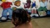 Fracturas y abuso infantil