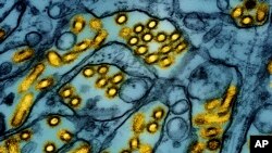 Arhiva: Obojena mikroskopska slika čestica Ptičje gripe, koju je objavio Nacionalni institut za alergije i infektivne bolesti, 26. marta 2024. (Foto: AP/CDC/NIAID)