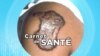 CARNET DE SANTE DU 2 OCTOBRE 2024 (Photo : DermNet)