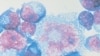 Topical Medication Might Provide Protection Against HIV