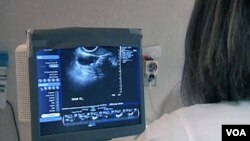 Un nuevo estudio señala que la aspirina podría reducir los riesgos de contraer cáncer