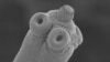 Man’s Life Saved When Tapeworm Removed from Brain