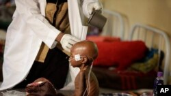 Un enfant mal nourri recevant des soins médicaux à Maiduguri, Nigeria, le 29 aout 2016. 