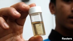 Tim kesehatan memperlihatkan tabung berisi larva nyamuk yang mereka kumpulkan selama inspeksi Zika di Singapura, 5 September 2016 (Foto: dok).