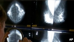 FILE - Radiologist uses magnifying glass to check mammograms for breast cancer in Los Angeles.