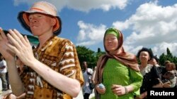Célébrations de la Journée mondiale de sensibilisation à l'albinisme à Dar es-Salaam, Tanzanie